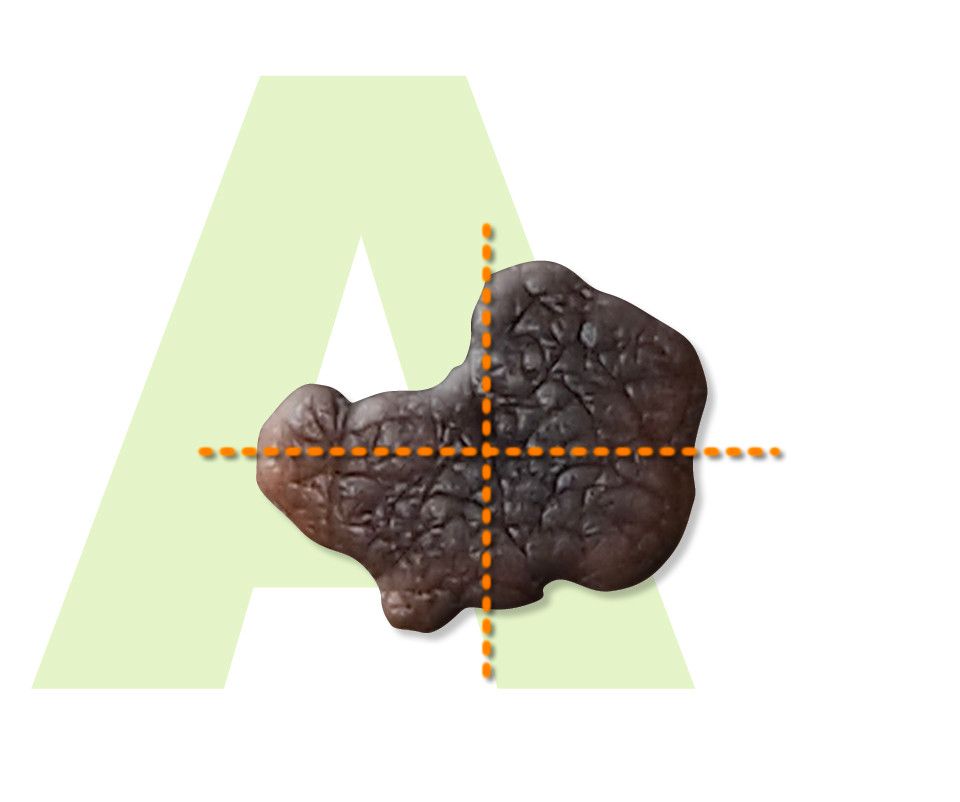 Assimmetria