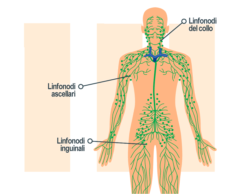 Stadio 3 melanoma