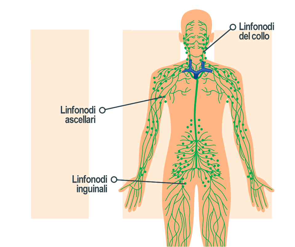 Stadio 3 melanoma