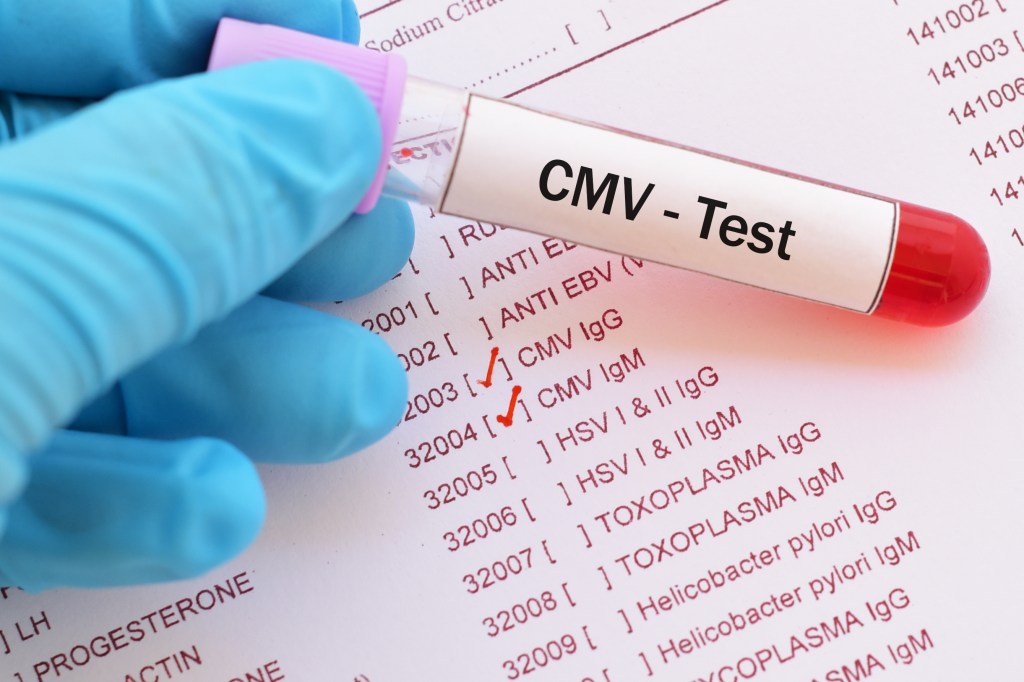 citomegalovirus cos'è